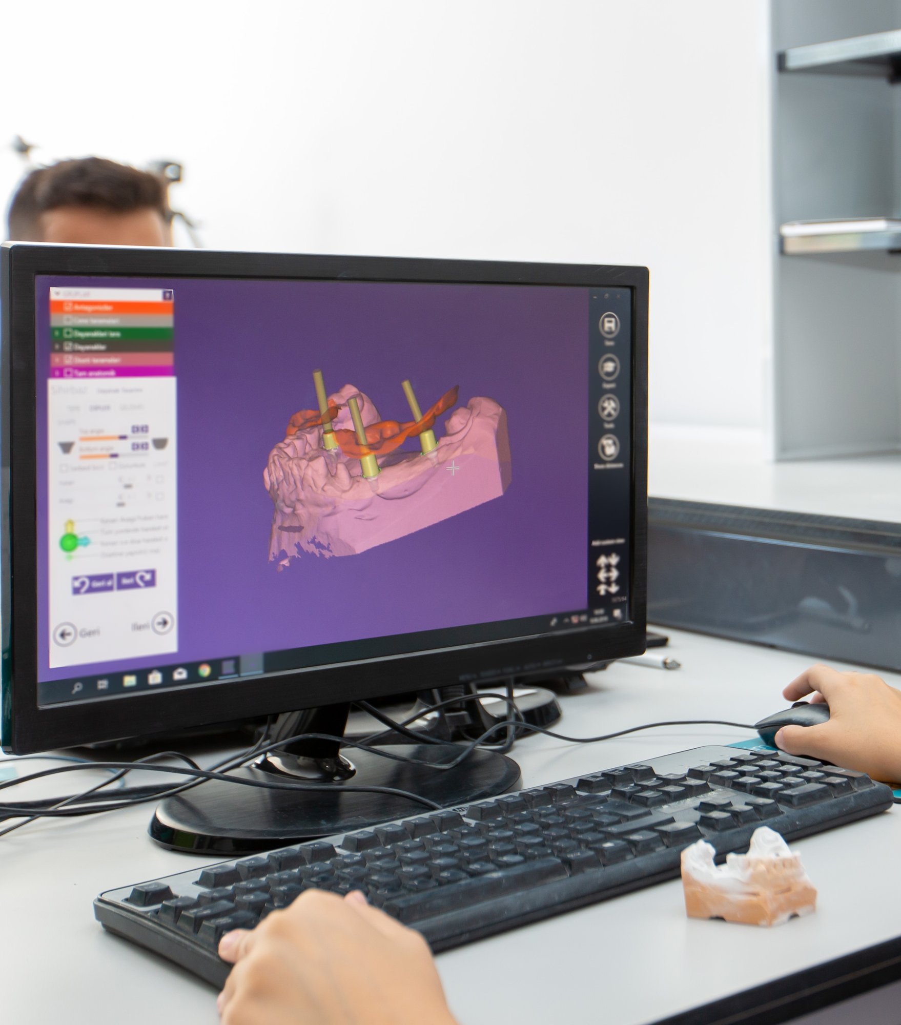 CAD/CAM technology at Renuix Dental Lab