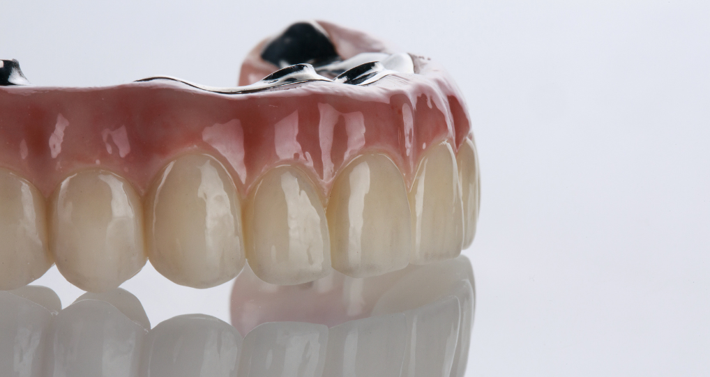 Full-Arch Restorations at Reniux Dental Lab