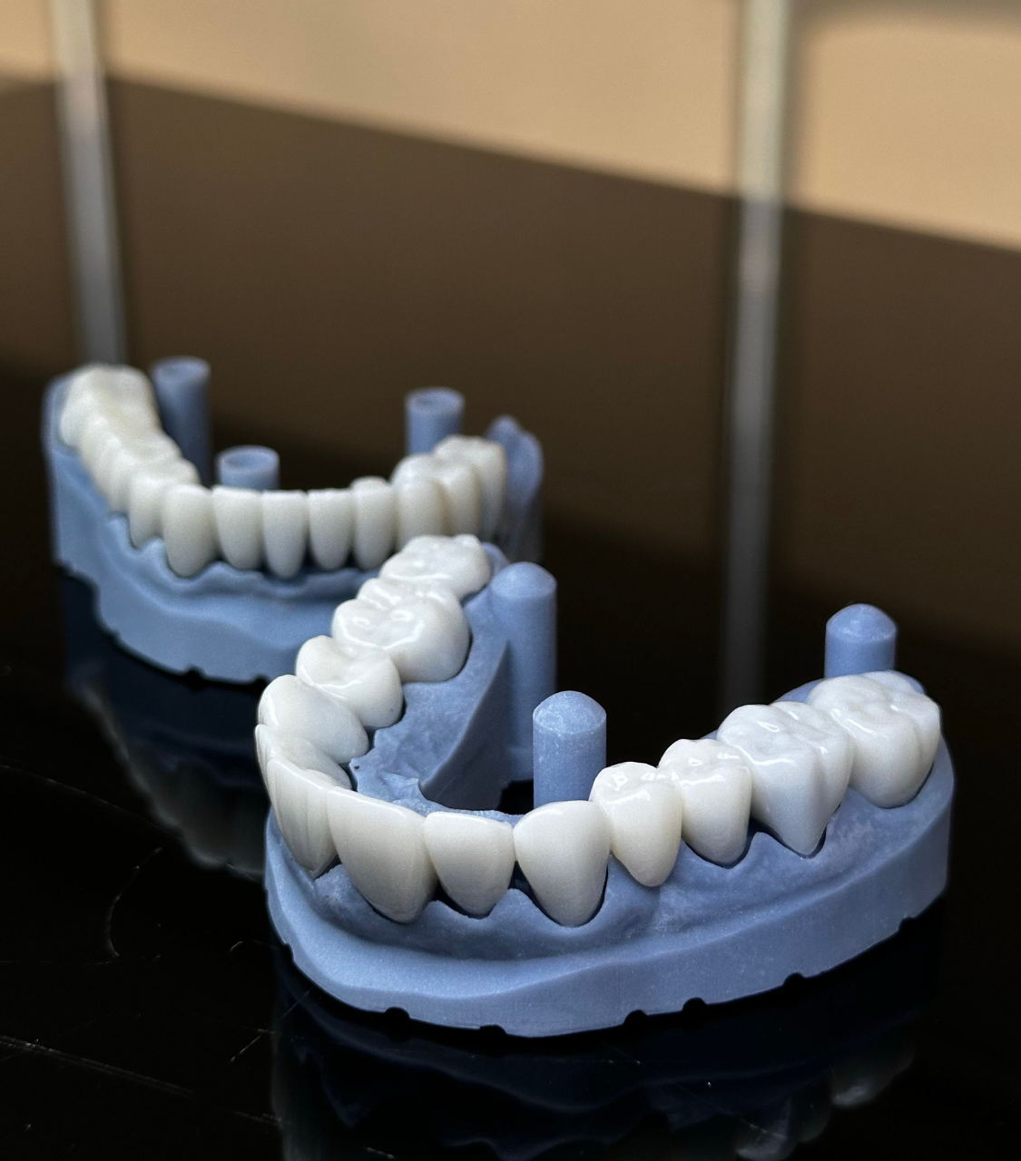 Zirconia Crowns at Reniux Dental Lab